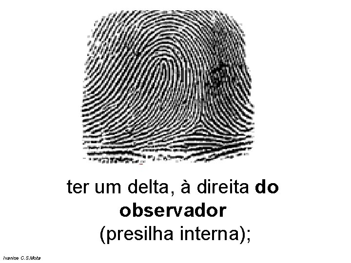 ter um delta, à direita do observador (presilha interna); Ivanise C. S. Mota ter um delta, à direita do observador (presilha interna); Ivanise C. S. Mota