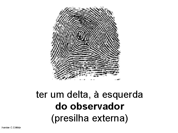 ter um delta, à esquerda do observador (presilha externa) Ivanise C. S. Mota ter um delta, à esquerda do observador (presilha externa) Ivanise C. S. Mota