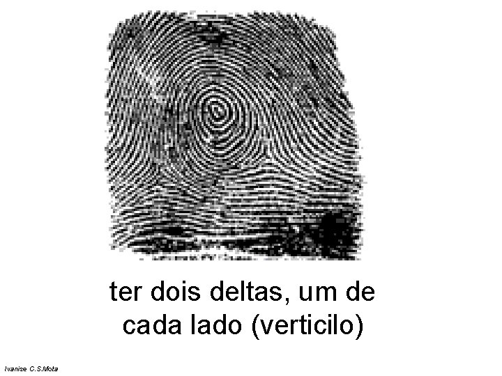 ter dois deltas, um de cada lado (verticilo) Ivanise C. S. Mota ter dois deltas, um de cada lado (verticilo) Ivanise C. S. Mota