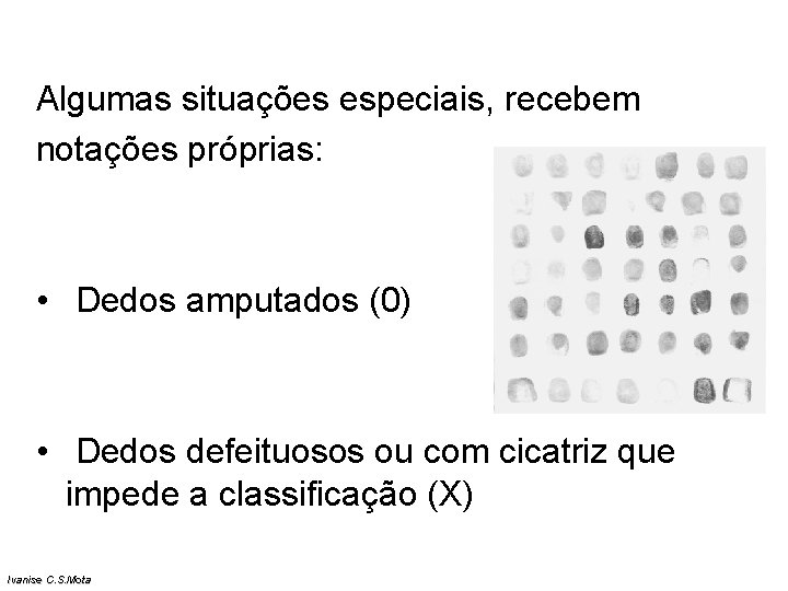 Algumas situações especiais, recebem notações próprias: • Dedos amputados (0) • Dedos defeituosos ou Algumas situações especiais, recebem notações próprias: • Dedos amputados (0) • Dedos defeituosos ou