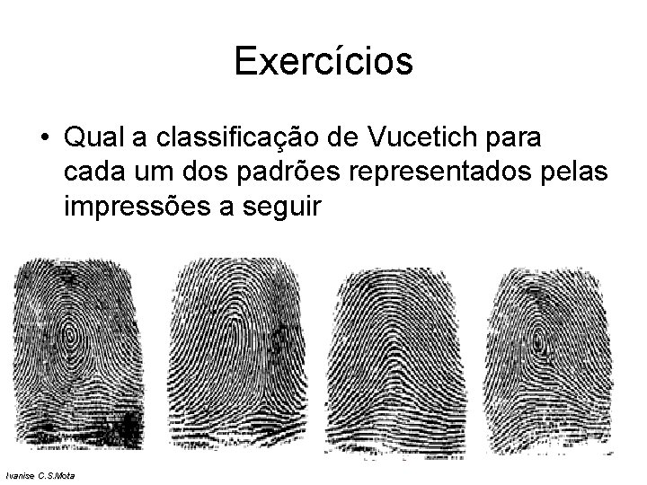 Exercícios • Qual a classificação de Vucetich para cada um dos padrões representados pelas Exercícios • Qual a classificação de Vucetich para cada um dos padrões representados pelas