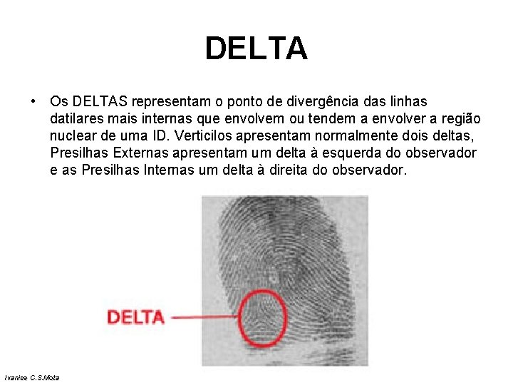 DELTA • Os DELTAS representam o ponto de divergência das linhas datilares mais internas DELTA • Os DELTAS representam o ponto de divergência das linhas datilares mais internas