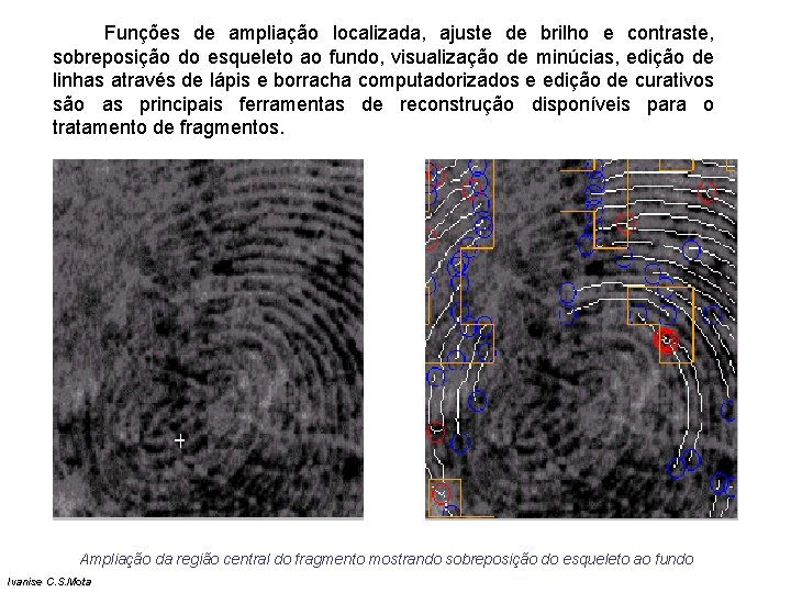 Funções de ampliação localizada, ajuste de brilho e contraste, sobreposição do esqueleto ao Funções de ampliação localizada, ajuste de brilho e contraste, sobreposição do esqueleto ao