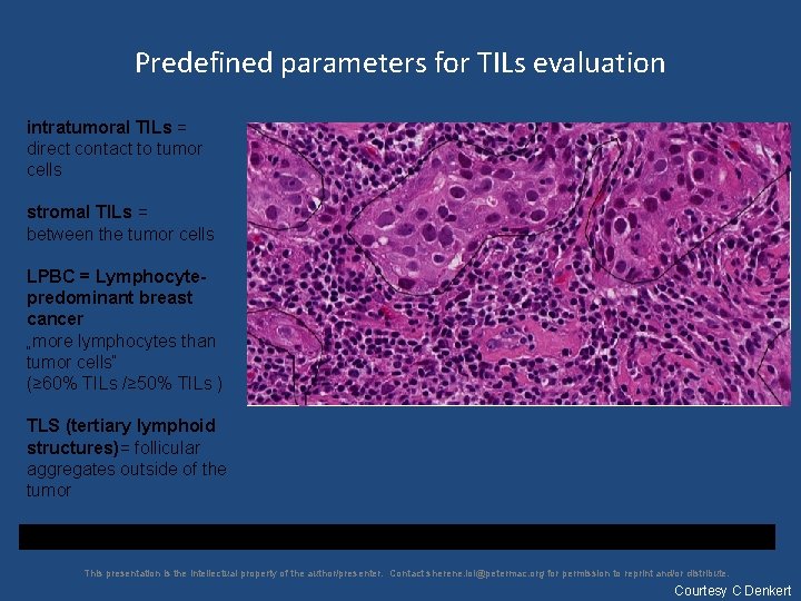 Predefined parameters for TILs evaluation intratumoral TILs = direct contact to tumor cells stromal