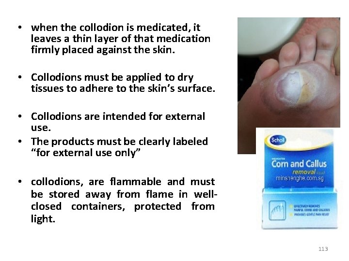  • when the collodion is medicated, it leaves a thin layer of that