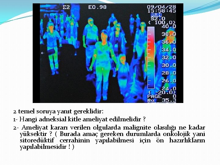 2 temel soruya yanıt gereklidir: 1 - Hangi adneksial kitle ameliyat edilmelidir ? 2