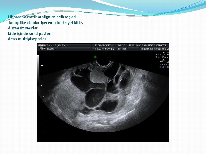 Ultrasonografik malignite belirteçleri: komplike alanlar içeren adneksiyel kitle, düzensiz sınırlar kitle içinde solid pattern