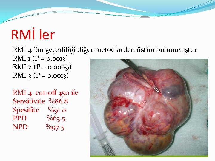 RMİ ler RMI 4 ‘ün geçerliliği diğer metodlardan üstün bulunmuştur. RMI 1 (P =