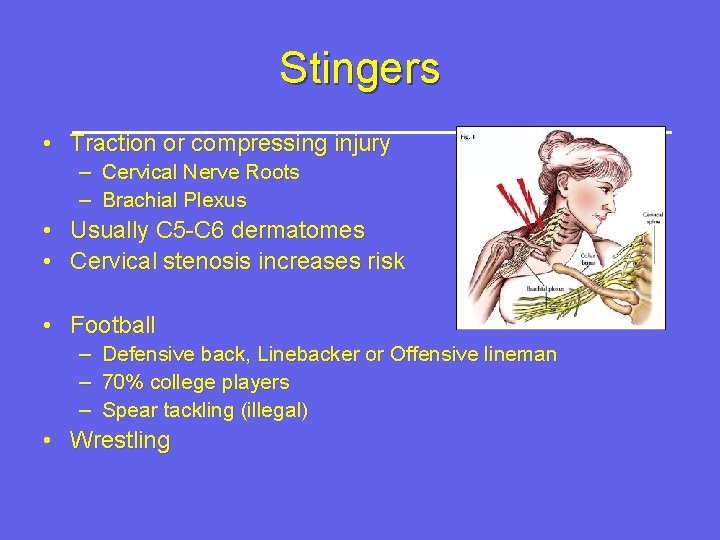 Stingers • Traction or compressing injury – Cervical Nerve Roots – Brachial Plexus •