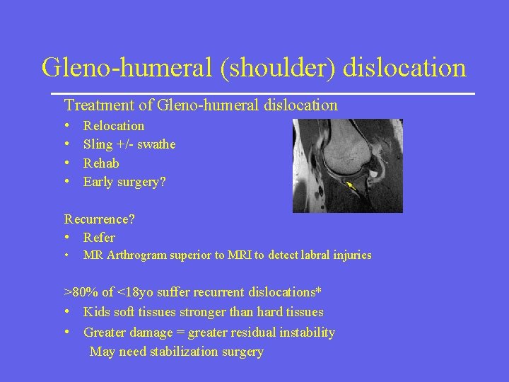Gleno-humeral (shoulder) dislocation Treatment of Gleno-humeral dislocation • • Relocation Sling +/- swathe Rehab