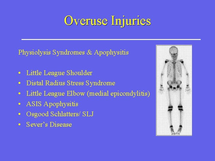Overuse Injuries Physiolysis Syndromes & Apophysitis • • • Little League Shoulder Distal Radius