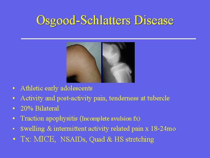 Osgood-Schlatters Disease • • Athletic early adolescents Activity and post-activity pain, tenderness at tubercle