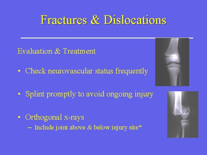 Fractures & Dislocations Evaluation & Treatment • Check neurovascular status frequently • Splint promptly