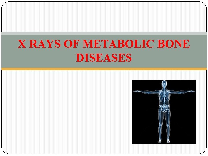 X RAYS OF METABOLIC BONE DISEASES 