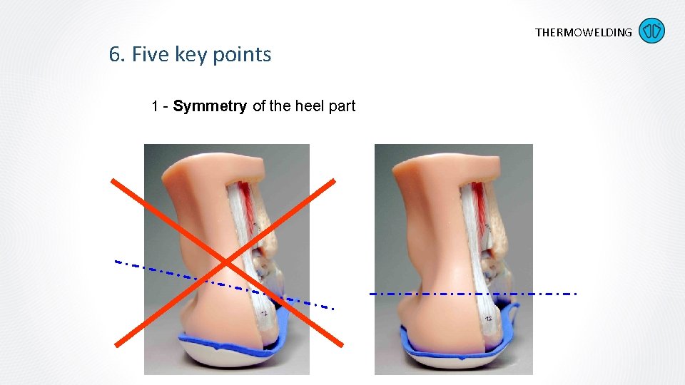 6. Five key points 1 - Symmetry of the heel part THERMOWELDING 