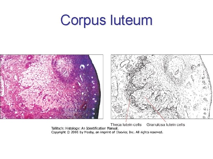 Corpus luteum 