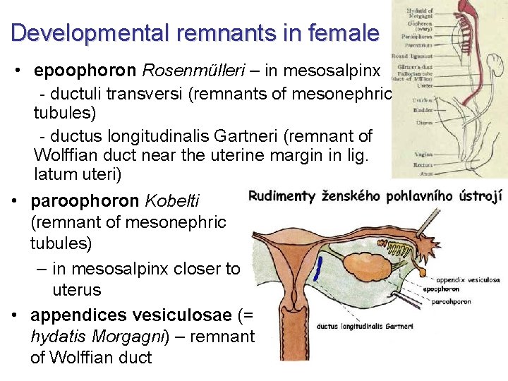 Developmental remnants in female • epoophoron Rosenmülleri – in mesosalpinx - ductuli transversi (remnants