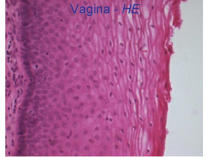 Vagina - HE 