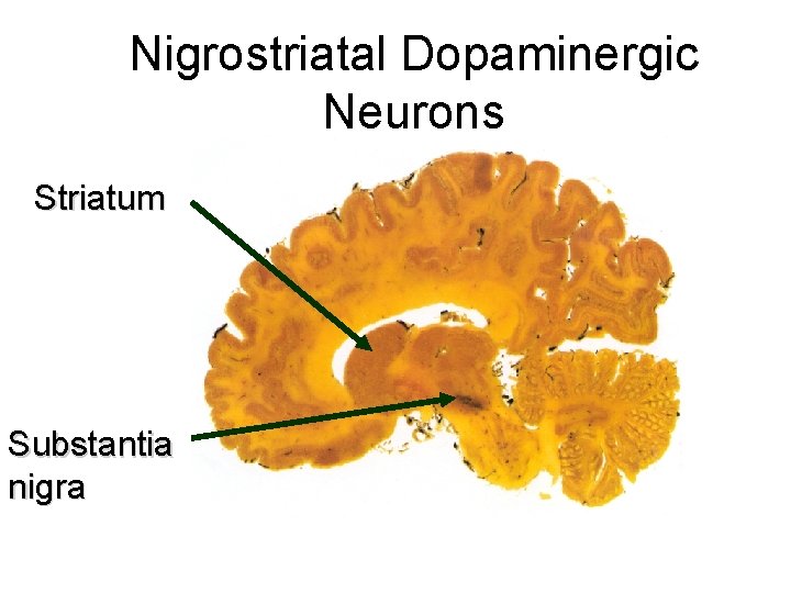 Nigrostriatal Dopaminergic Neurons Striatum Substantia nigra 