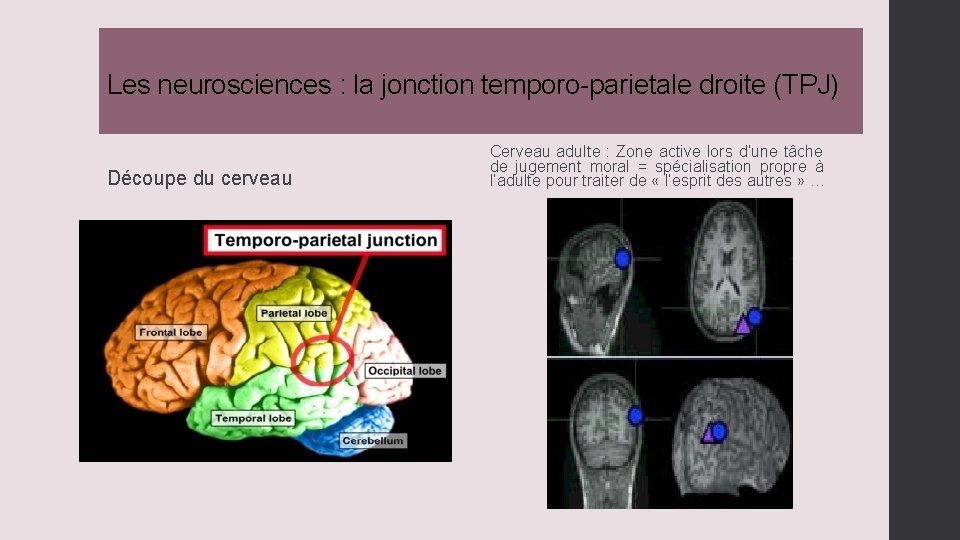 Les neurosciences : la jonction temporo-parietale droite (TPJ) Découpe du cerveau Cerveau adulte :