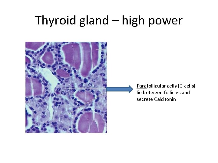 Thyroid gland – high power Parafollicular cells (C-cells) lie between follicles and secrete Calcitonin