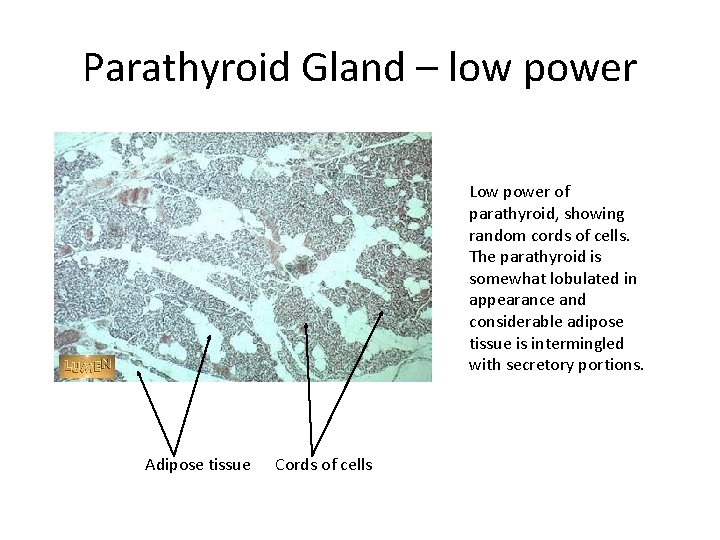 Parathyroid Gland – low power Low power of parathyroid, showing random cords of cells.