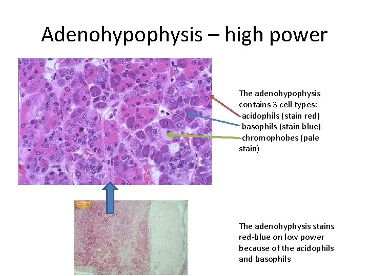 Adenohypophysis – high power The adenohypophysis contains 3 cell types: -acidophils (stain red) -basophils