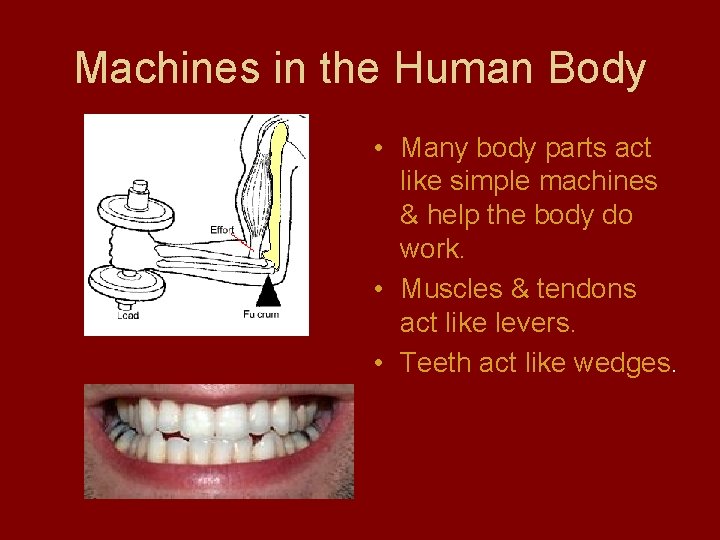 Machines in the Human Body • Many body parts act like simple machines &