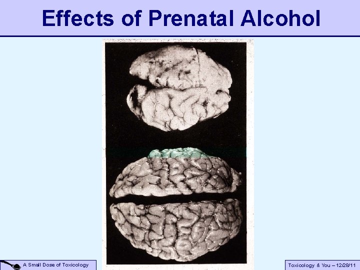 Effects of Prenatal Alcohol A Small Dose of Toxicology & You – 12/28/11 Effects of Prenatal Alcohol A Small Dose of Toxicology & You – 12/28/11