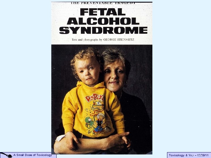 A Small Dose of Toxicology & You 12/28/11 FAS–Child A Small Dose of Toxicology & You 12/28/11 FAS–Child