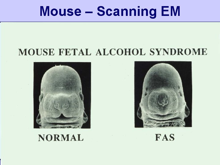 Mouse – Scanning EM A Small Dose of Toxicology & You – 12/28/11 Mouse – Scanning EM A Small Dose of Toxicology & You – 12/28/11