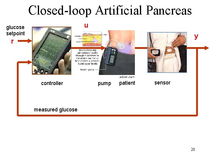 Closed-loop Artificial Pancreas u glucose setpoint y r controller pump patient sensor measured glucose