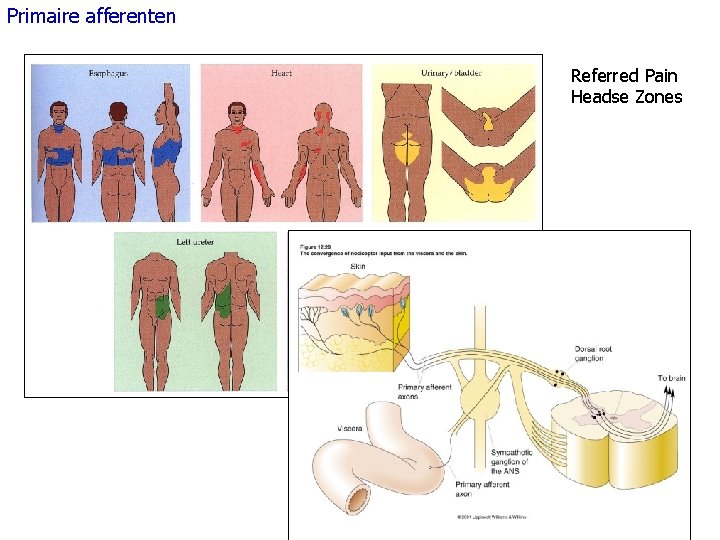 Primaire afferenten Referred Pain Headse Zones 