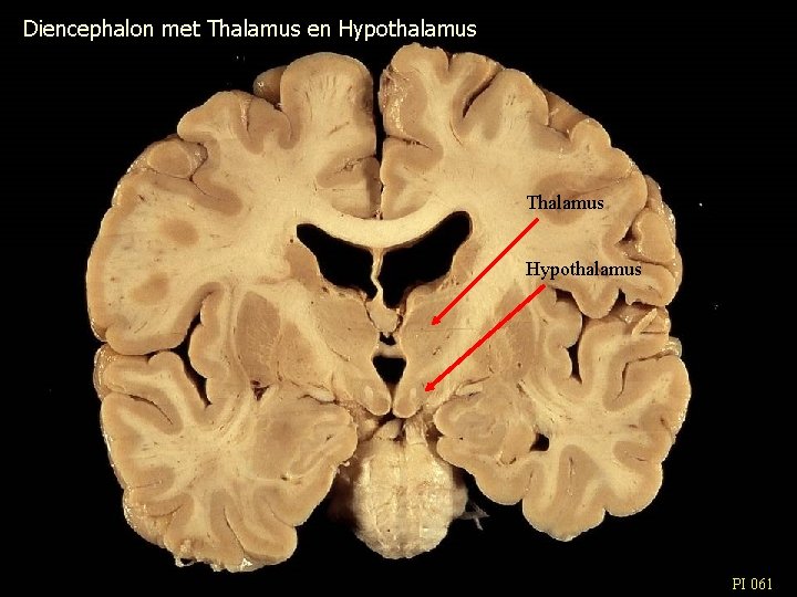 Diencephalon met Thalamus en Hypothalamus Thalamus Hypothalamus PI 061 