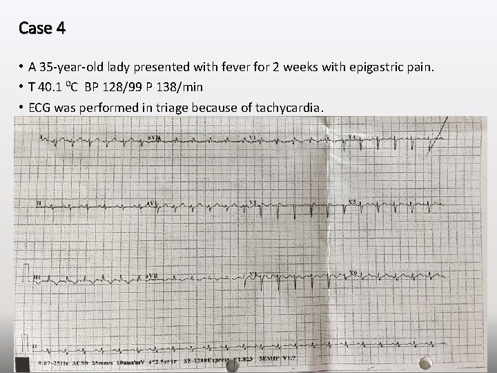 Case 4 • A 35 -year-old lady presented with fever for 2 weeks with