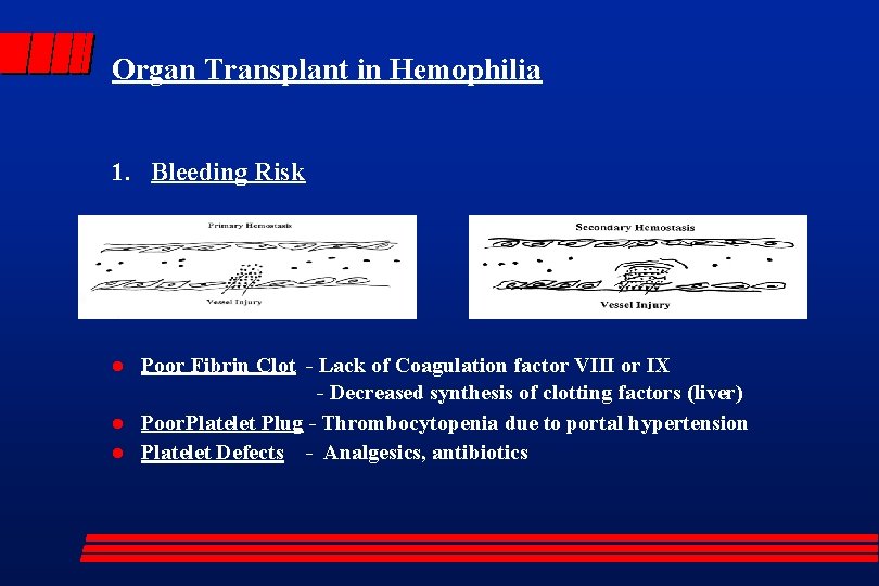 Organ Transplant in Hemophilia 1. Bleeding Risk l l l Poor Fibrin Clot -