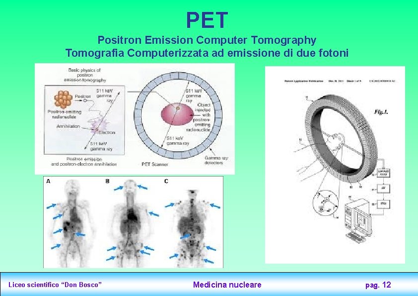 PET Positron Emission Computer Tomography Tomografia Computerizzata ad emissione di due fotoni Liceo scientifico