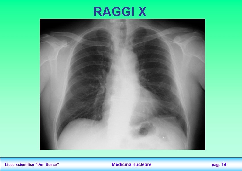 RAGGI X Liceo scientifico “Don Bosco” Medicina nucleare pag. 14 