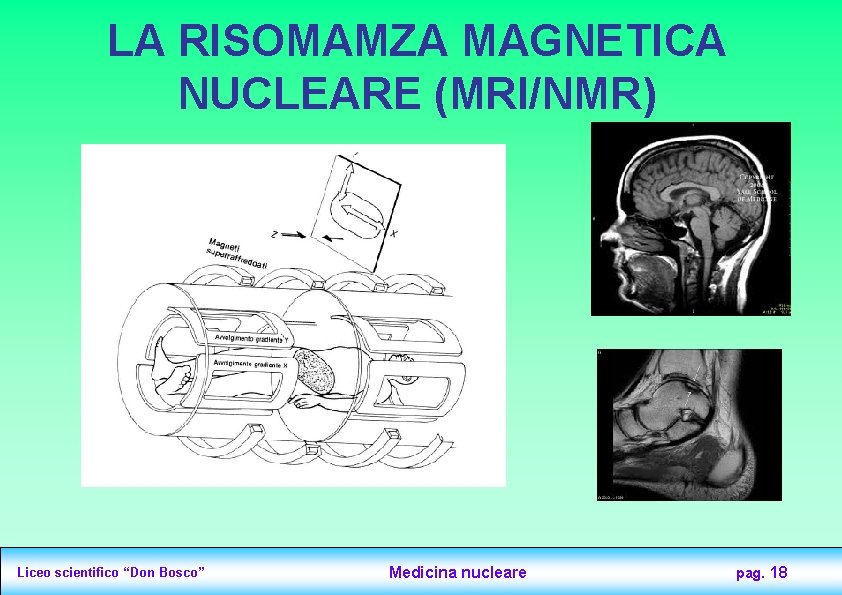 LA RISOMAMZA MAGNETICA NUCLEARE (MRI/NMR) Liceo scientifico “Don Bosco” Medicina nucleare pag. 18 