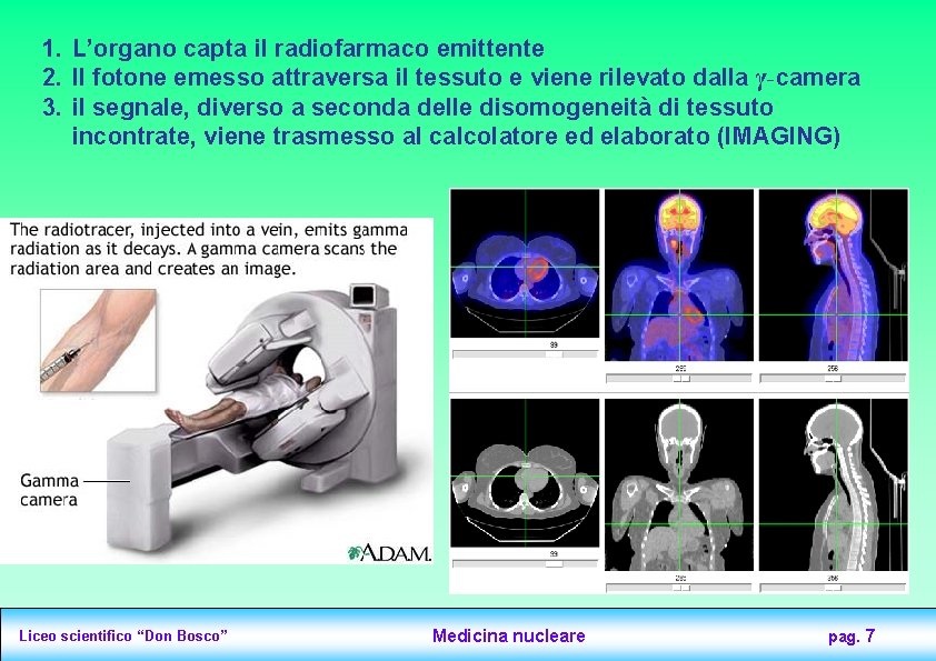 1. L’organo capta il radiofarmaco emittente 2. Il fotone emesso attraversa il tessuto e