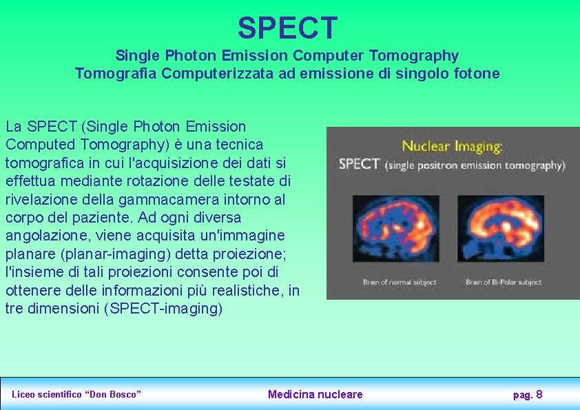 SPECT Single Photon Emission Computer Tomography Tomografia Computerizzata ad emissione di singolo fotone La