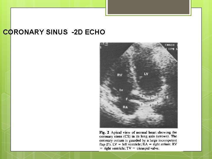 CORONARY SINUS -2 D ECHO 