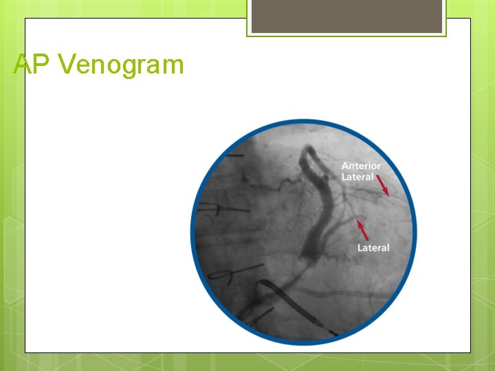 AP Venogram 