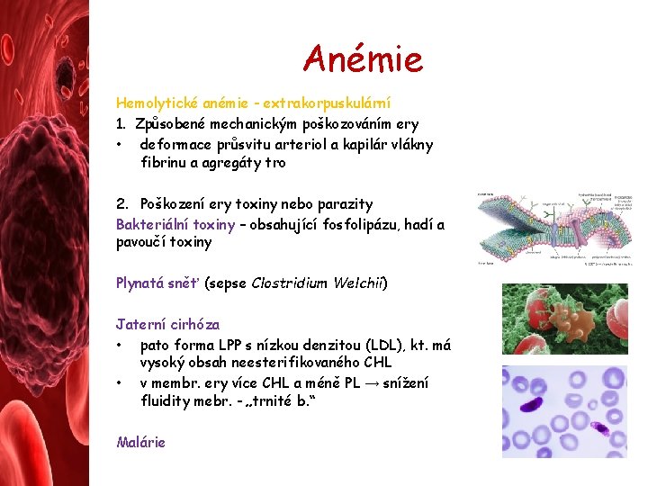 Anémie Hemolytické anémie - extrakorpuskulární 1. Způsobené mechanickým poškozováním ery • deformace průsvitu arteriol