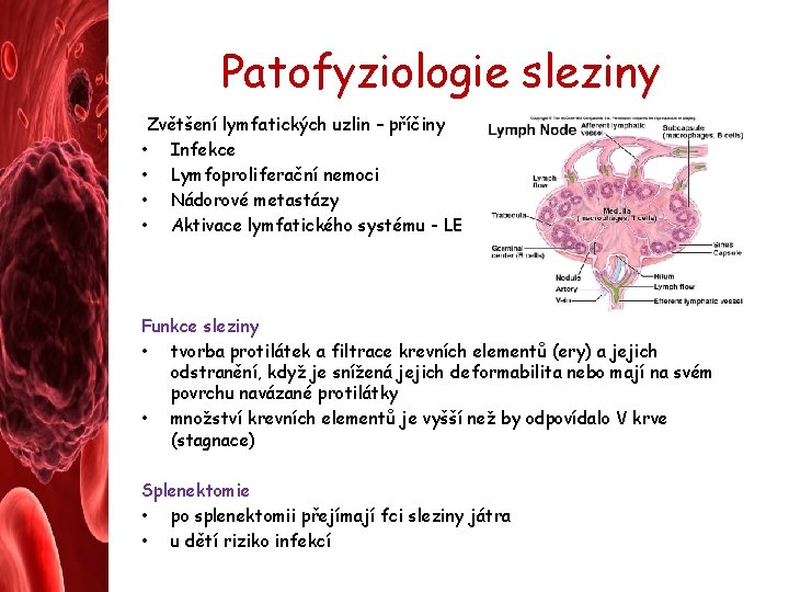 Patofyziologie sleziny Zvětšení lymfatických uzlin – příčiny • Infekce • Lymfoproliferační nemoci • Nádorové