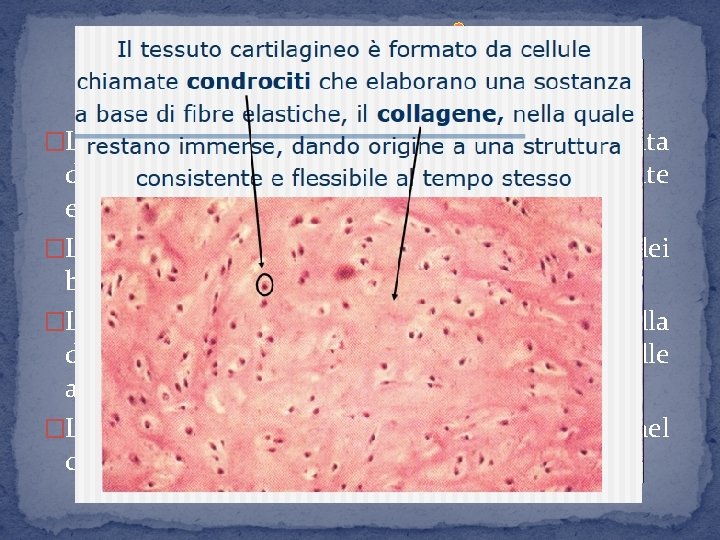 �La cartilagine è una struttura di sostegno formata da tessuto molto ricco di acqua