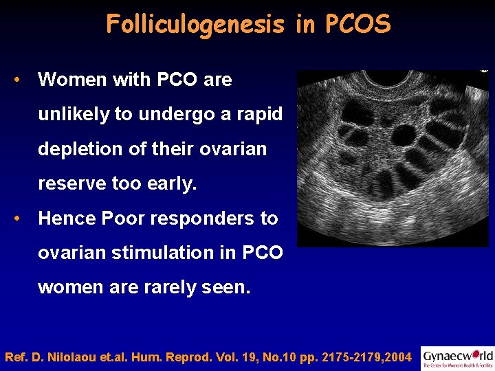 Folliculogenesis in PCOS • Women with PCO are unlikely to undergo a rapid depletion