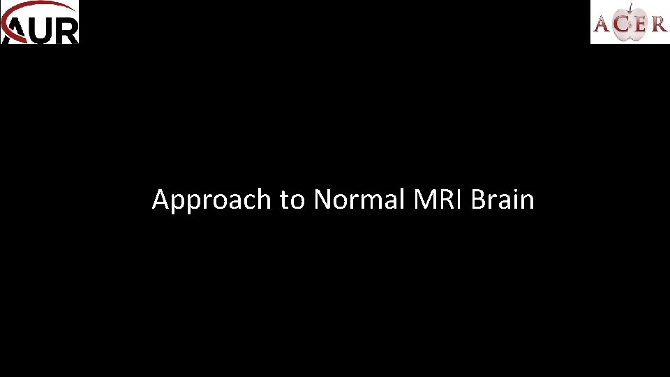 Approach to Normal MRI Brain 