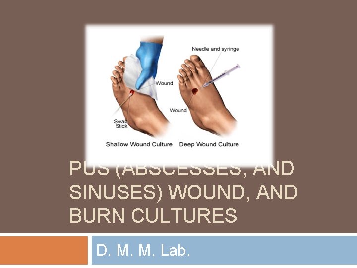 PUS (ABSCESSES, AND SINUSES) WOUND, AND BURN CULTURES D. M. M. Lab. 