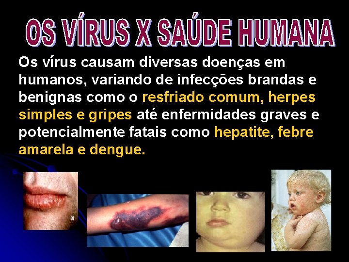 Os vírus causam diversas doenças em humanos, variando de infecções brandas e benignas como